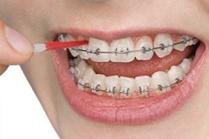 Interdental Brush